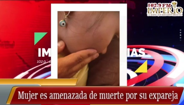 Ante inacción policial, mujer vive bajo constantes maltratos y amenazas de su pareja - Radio Imperio