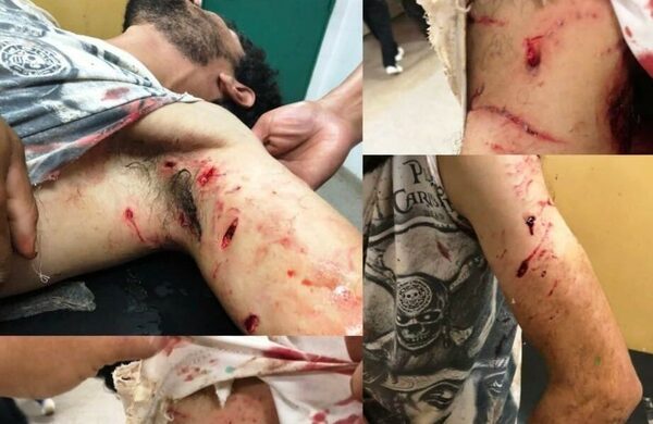 Jagua Pitbull atacó a un albañil y lo dejó con el brazo destrozado