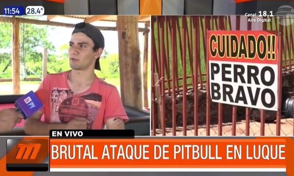 Brutal ataque de pitbull en Luque | Telefuturo