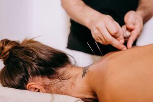 Todo lo que necesitas saber sobre la acupuntura