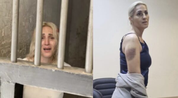 Funcionaria del Senado denuncia a efectivos policiales tras sufrir brutal agresión - Noticiero Paraguay