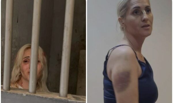 Funcionaria del Congreso denuncia ‘tortura’ en la comisaría. He’i que fue por orden de la actual pareja de su ex