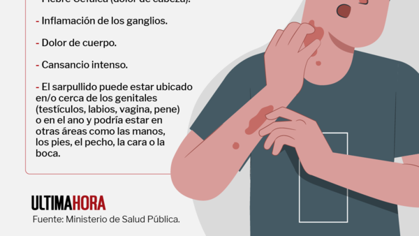 Preocupante aumento de casos de viruela del mono en Central
