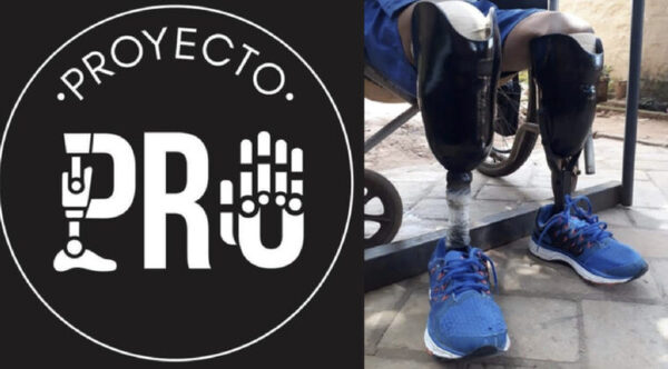 Proyecto PRO: prótesis accesibles para transformar vidas