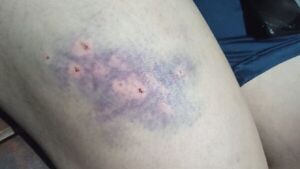 Persona trans sufre agresión por parte de hombres en Itauguá