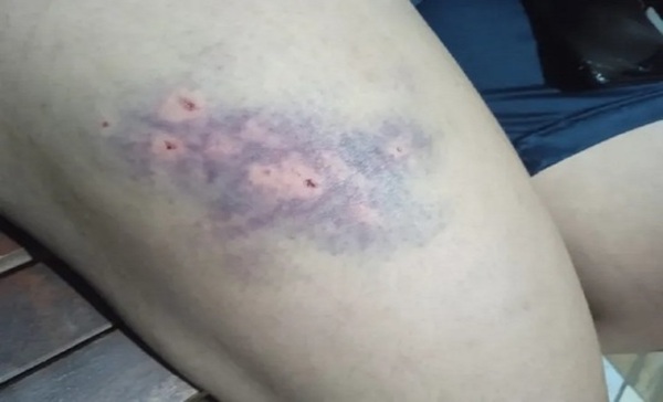 Itauguá: Persona trans habría sido víctima de brutal golpiza - Paraguaype.com