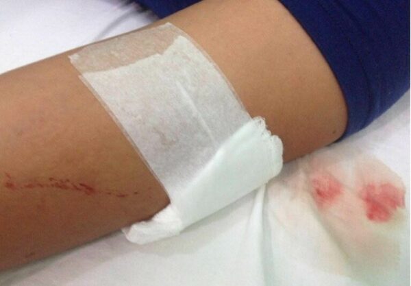 En medio de una riña de vecinos, doña hiere con cuchillo a su hija