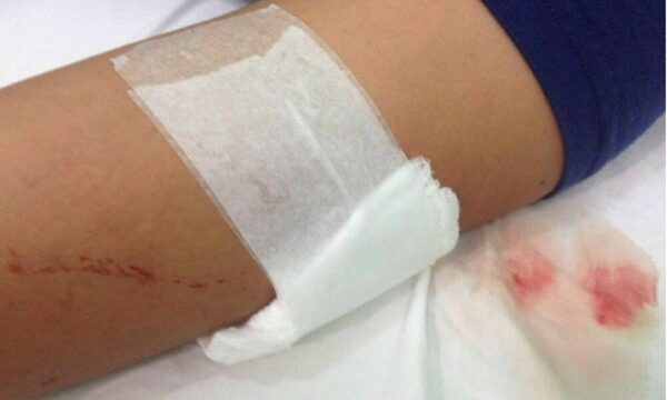 En medio de una riña de vecinos doña hiere con cuchillo a su hija
