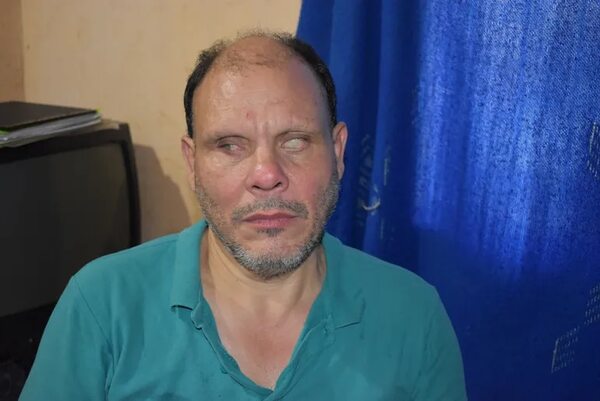 IPS corta pensión y el seguro a persona con discapacidad visual exige devolver casi G. 100 millones - Nacionales - ABC Color