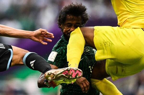 Crónica / La terrible lesión facial que sufrió el jugador árabe que chocó con su arquero