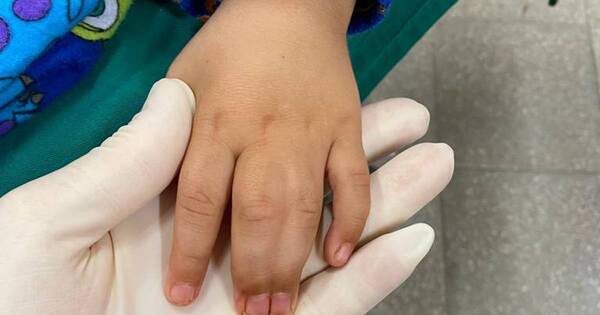 La Nación / Médicos de fundación alemana hicieron 80 cirugías reconstructivas en niños y adultos