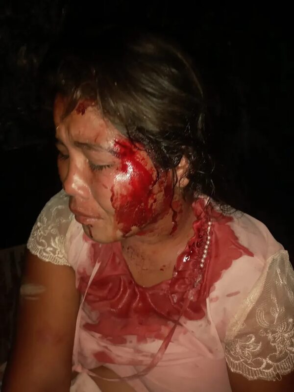 Víctima de violencia familiar clama ayuda a la Justicia en Fuerte Olimpo - Noticias del Chaco - ABC Color