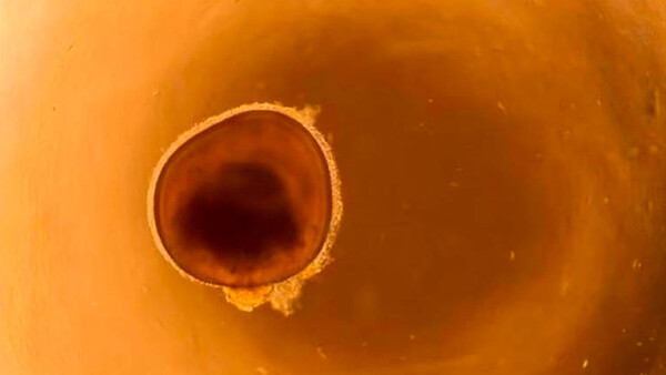 Diario HOY | Crean miniojos en laboratorio que podrían ayudar a curar la ceguera
