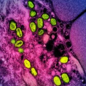 Virus de la viruela del mono podría transmitirse también por vía aérea - Ciencia - ABC Color