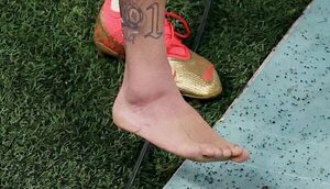 La preocupante imagen del tobillo de Neymar que tiene en vilo a Brasil