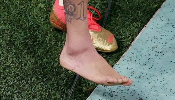 La preocupante imagen del tobillo de Neymar que tiene en vilo a Brasil