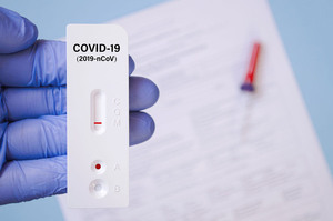 COVID, en aumento: Más del 60% de los casos confirmados son reinfecciones - Megacadena — Últimas Noticias de Paraguay