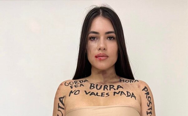 Diario HOY | Laurys Dyva en el #25N: "Las palabras también lastiman"