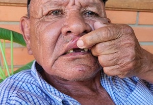 Concepción: Una mujer golpea a su suegro y le echa 3 dientes