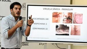 Casos de viruela del mono suben a 22 y todos son de Asunción y Central
