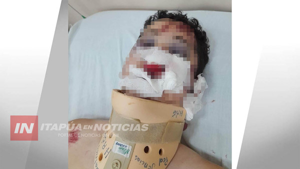 ADOLESCENTE EN GRAVE ESTADO TRAS PRESUNTAMENTE SER EMBESTIDO POR UN VEHÍCULO