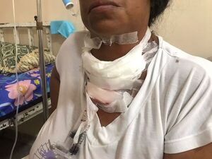Cirugía exitosa de bocio en el Hospital Regional de Encarnación