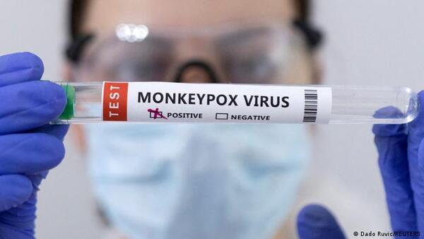 OMS cambia el nombre a la viruela del mono: ahora se llama mpox