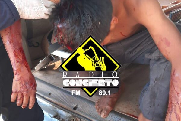 Rompen la cabeza a indígena durante ronda de tragos