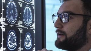 Diario HOY | Fármaco busca frenar el alzhéimer: ensayo clínico obtuvo buenos y malos resultados