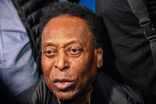 Pelé internado, informan medios brasileños | 1000 Noticias