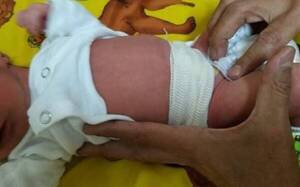 Fajar ombligo del bebé es totalmente innecesario, he’i pediatra