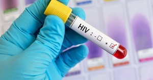 Más de 1.000 personas fueron diagnosticadas con VIH en lo que va del año