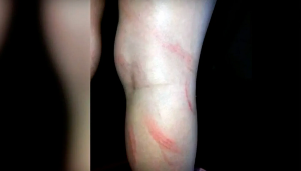 Arriero infeliz con orden de captura tras golpear brutalmente a su hija