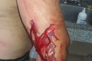 Acuchillan a hombre en Hernandarias