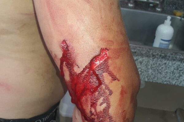 Acuchillan a hombre en Hernandarias