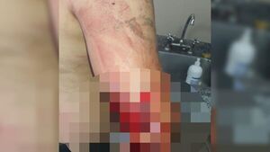 Le clavó a su socio en farra de fin de año