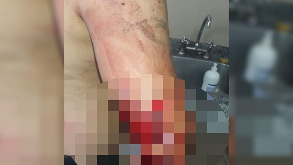 Le clavó a su socio en farra de fin de año