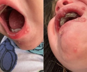 No dejes que nadie bese a tu bebé, aunque se enojen, aconseja pediatra - trece