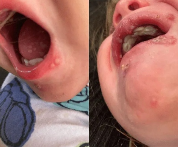 No dejes que nadie bese a tu bebé, aunque se enojen, aconseja pediatra - trece