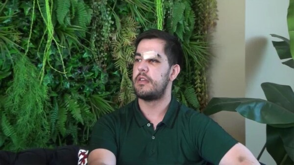 Habló el joven agredido por una turba durante el Encartour en la costanera