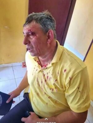 Video: precandidatos del oficialismo y cartismo, a los golpes en Tebicuary - Política - ABC Color