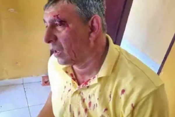 Precandidatos del oficialismo y cartismo, a los golpes en Tebicuary - Noticiero Paraguay