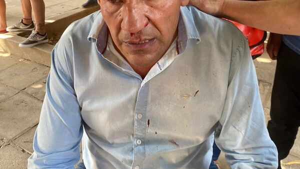 Agreden a precandidato a concejal departamental del Guairá