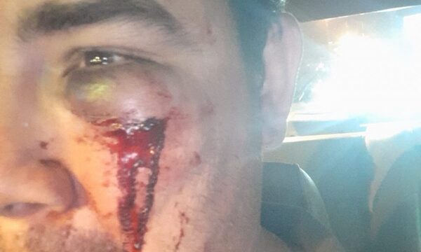 Un hombre sufre feroz corte en la cara al ser golpeado con botella de cerveza – Diario TNPRESS