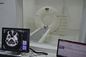 Sin tomógrafo en hospitales de referencia, denuncian pacientes oncológicos  - Nacionales - ABC Color