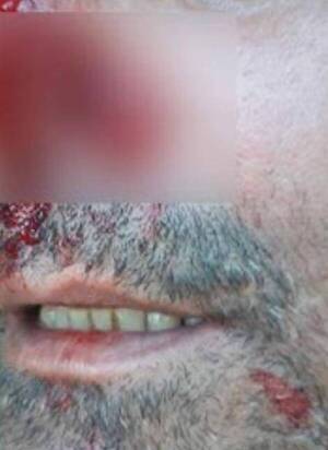 ¡Ñandejara! De un mordisco le arrancó la nariz a su papá