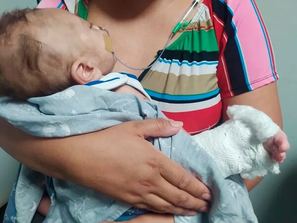 IPS dice que investigarán supuesta negligencia médica cometida contra un bebé de 4 meses - Nacionales - ABC Color