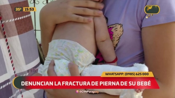 Denuncian la fractura de pierna de su bebé - C9N