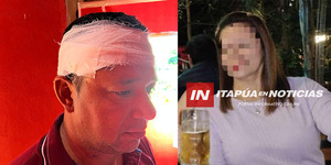 M. OTAÑO: MUJER HABRÍA INTENTADO MATAR A SU EX PAREJA A PIEDRAZOS - Itapúa Noticias