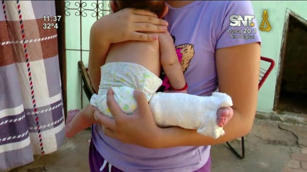 Fracturaron a un bebé en el Hospital del IPS - SNT